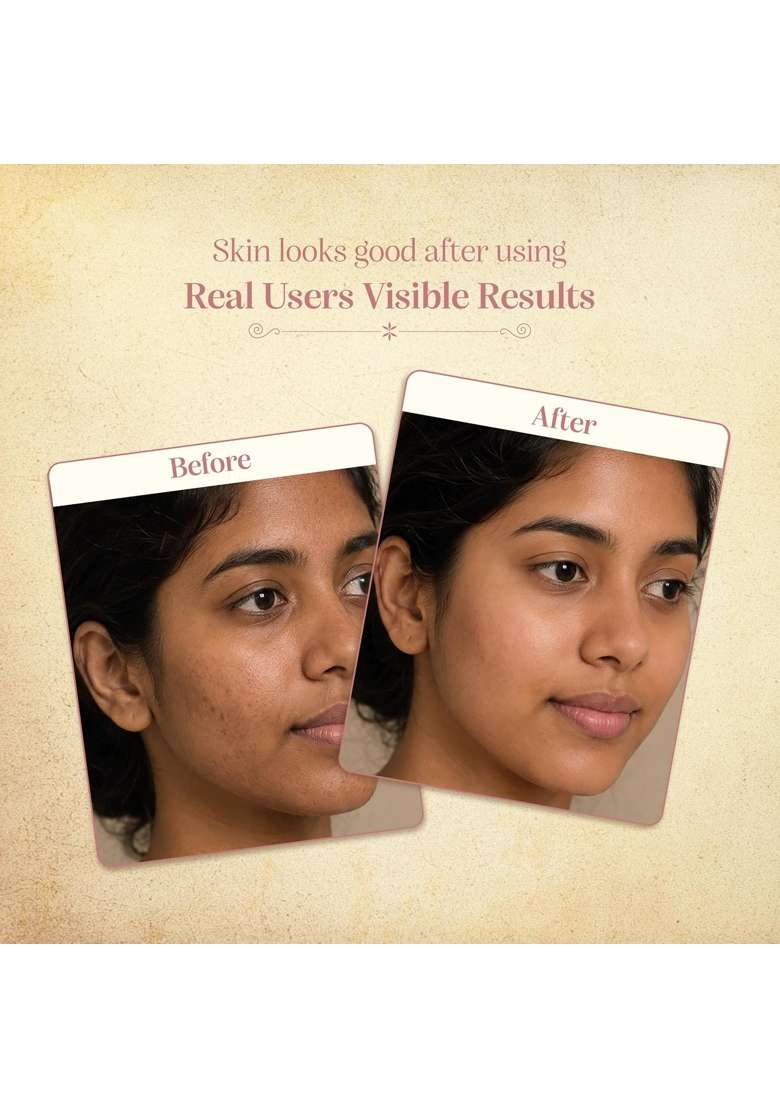 Chengavi Manjishtadi Clay Face Mask 50G Ayurvedic Ubtan Style Face Pack - Indya