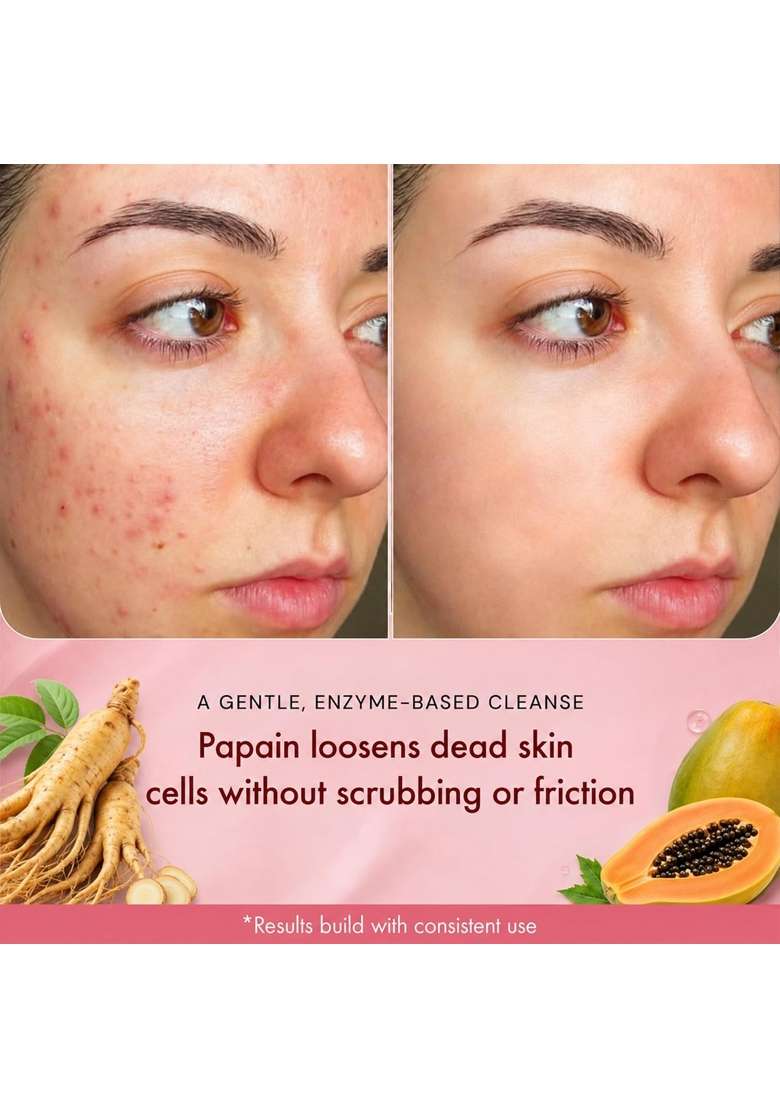Sonrisa White K Beauty 50G Korean Skin Care Enzyme Cleanser for Sensitive Skin - Indya