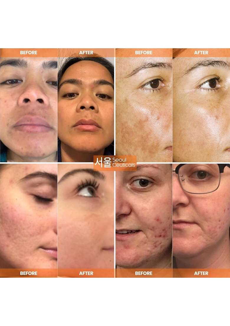 Orange Seoulceuticals Korean Vitamin C Serum for Glowing Skin - Indya