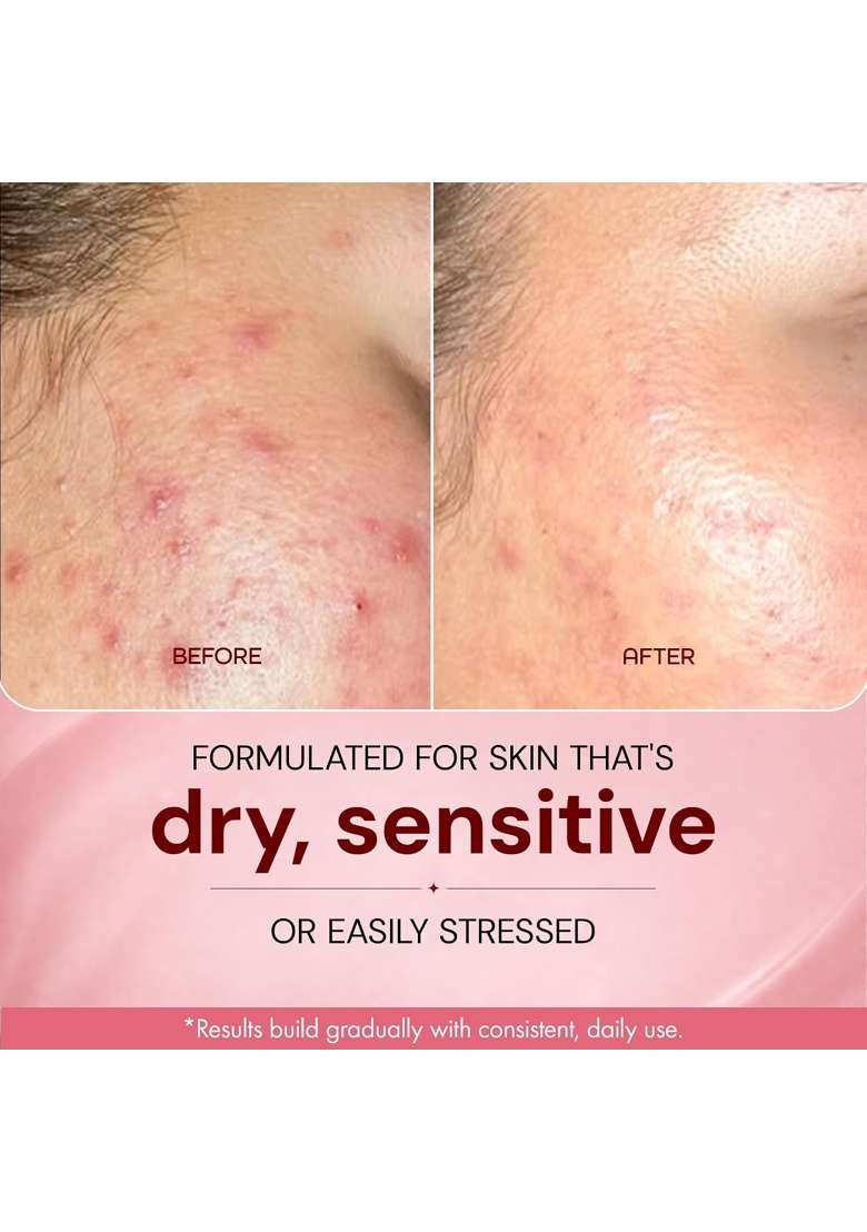 Sonrisa K Beauty 100ML Korean Skin Care with Centella Asiatica and Aloe Vera Calming Formula - Indya