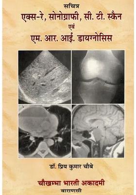 X-Ray, Sonography, CT Scan MRI Diagnosis (with Radiographs)