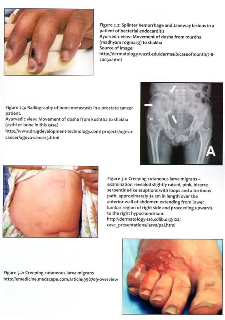 Interactive Workshop on Ayurveda (Clinical Diagnosis in Subjective and Objective Approach) - Indya