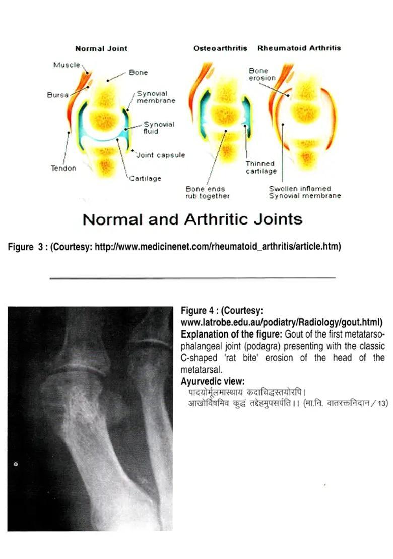 Interactive Workshop On Ayurveda (Asthivaha Srotas, Disorders of Bones and Joints Including Fractures their Management) - Indya