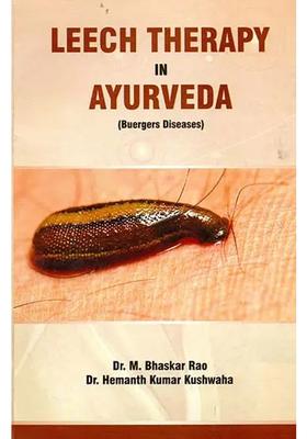 Leech Therapy in Ayurveda (Buergers Diseases)