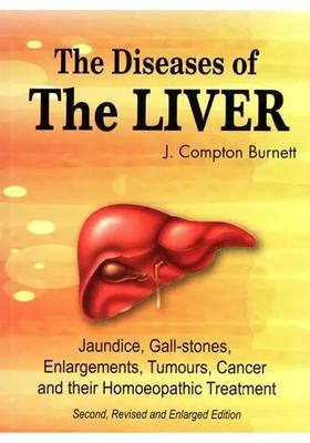 The Diseases of Liver (Jaundice, Gall-Stones, Enlargements, Tumours, Cancer and their Homoeopathic Treatment)