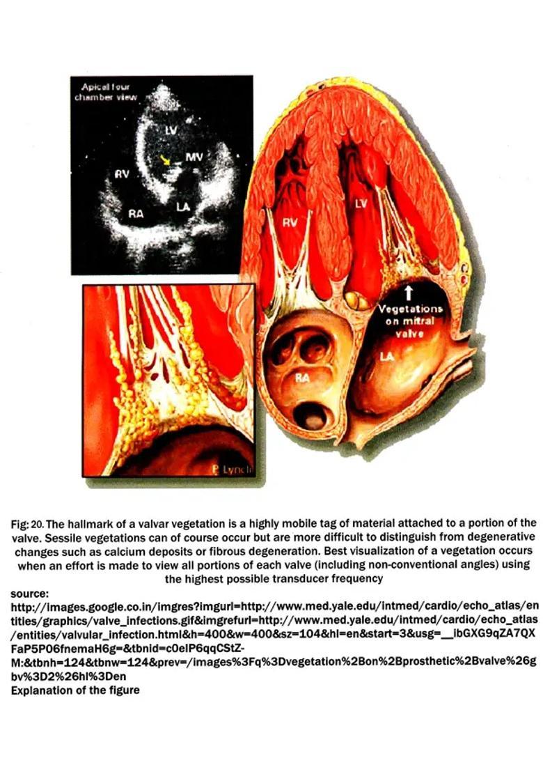 Interactive Workshop on Ayurveda (Raktavaha Srotas Related to Cardio Vascular System, Disorders and Management) - Indya