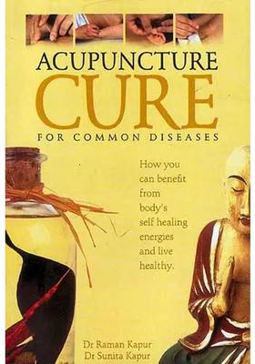 Acupuncture Cure For Common Diseases