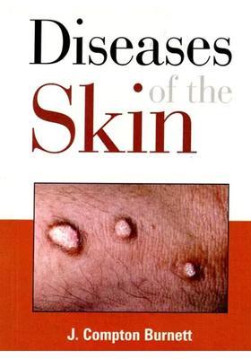 Diseases of the Skin (Their Constitutional Nature and Homeopathic Cure)