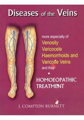 Diseases of The Veins (More Especially Venosity Varicocele Haemorrhoids and Varicose Their Homoeopathic Treatment)