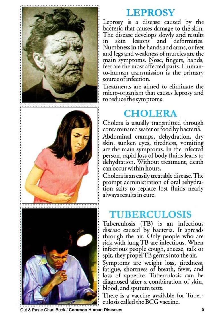 Cut Paste Common Human Diseases (Chart Book) - Indya