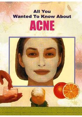 All You Wanted to Know About Acne