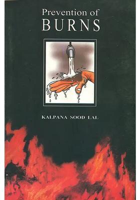 Prevention of Burns (A Handbook on Burn Injuries)