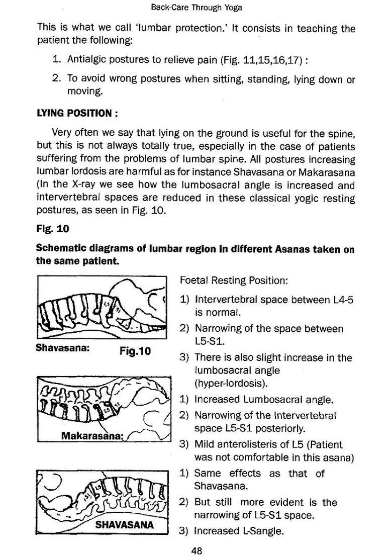 Back Care Through Yoga Cervical Spondylosis And Backache - Indya