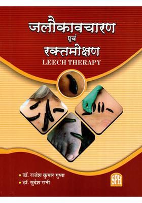 Jalaukavacharana and Raktamokshana- Leech Therapy