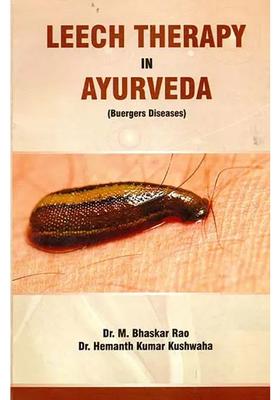 Leech Therapy in Ayurveda (Buergers Diseases)