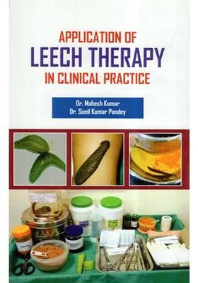 Application Of Leech Therapy In Clinical Practice