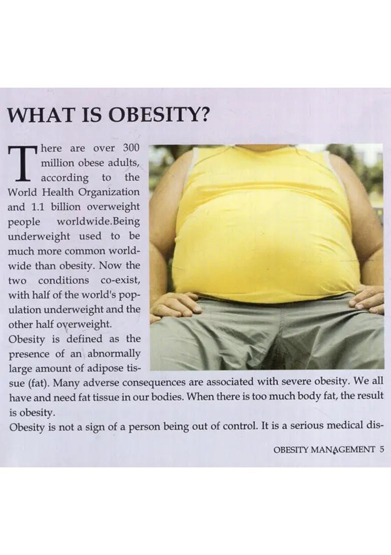 Obesity Management- Unlocking the Secrets of Weight Gain from Your Food Habits Physical Activity - Indya