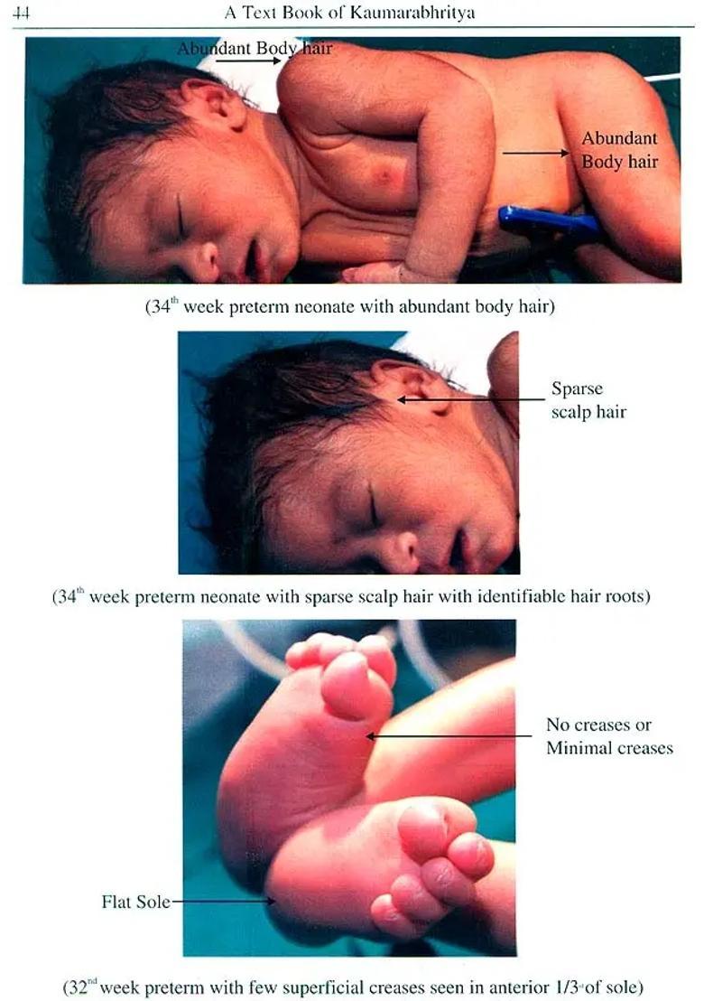 A Text Book of Kaumarabhritya (According to The New Syllabus of BAMS Course) - Indya