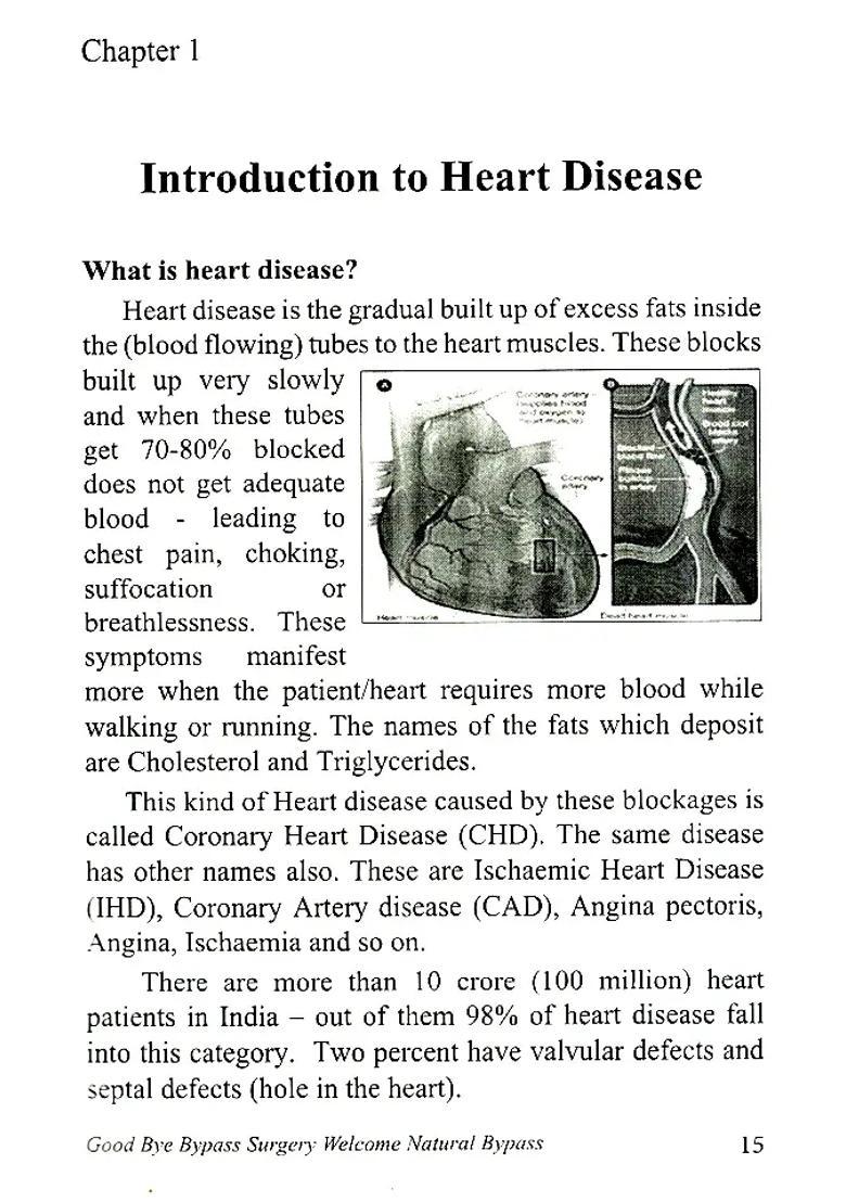 Good Bye Bypass Surgery Welcome Natural Bypass (A To Z Information on ECPEECP) - Indya