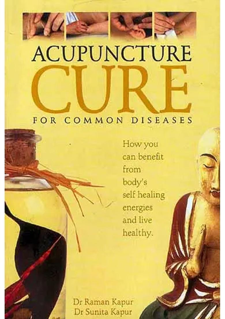 Acupuncture Cure For Common Diseases - Indya