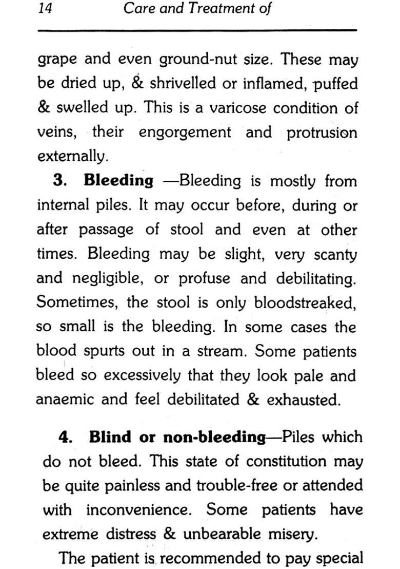 Piles, Fistula, Fissure, Prolapse, Constipation and Their Homeopathic Management (Includes Case Taking, Diet, Hygiene Yoga) - Indya