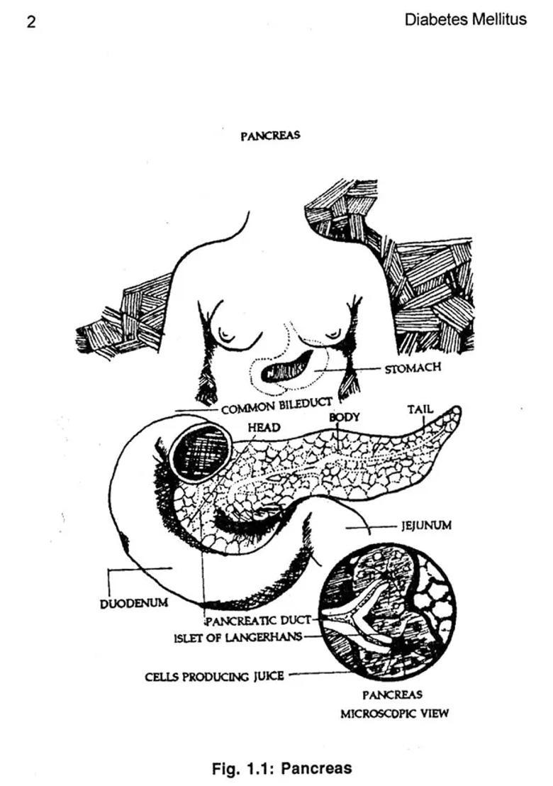 Diabetes Mellitus (Basic Facts With Homeopathic Treatment) - Indya