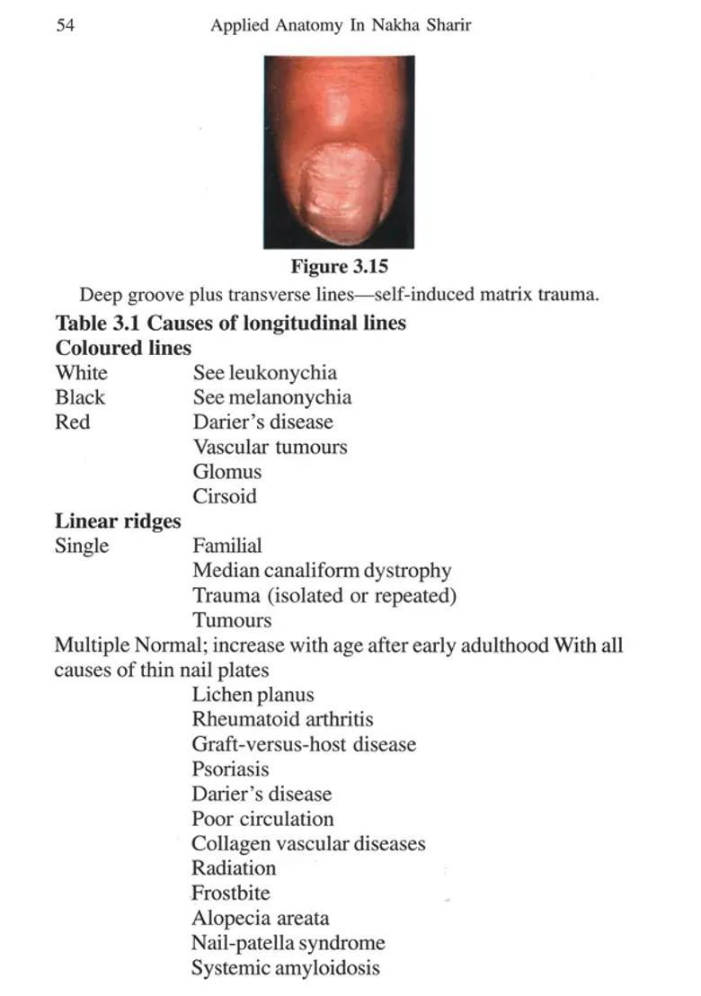 Applied Anatomy in Nakha Sharir - Indya