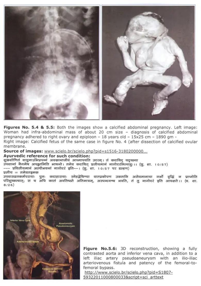 Interactive Training Programme for PG Students and Teachers of Ayurveda - Indya