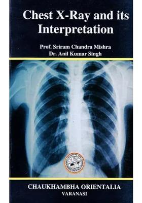 Chest X-Ray and its Interpretation