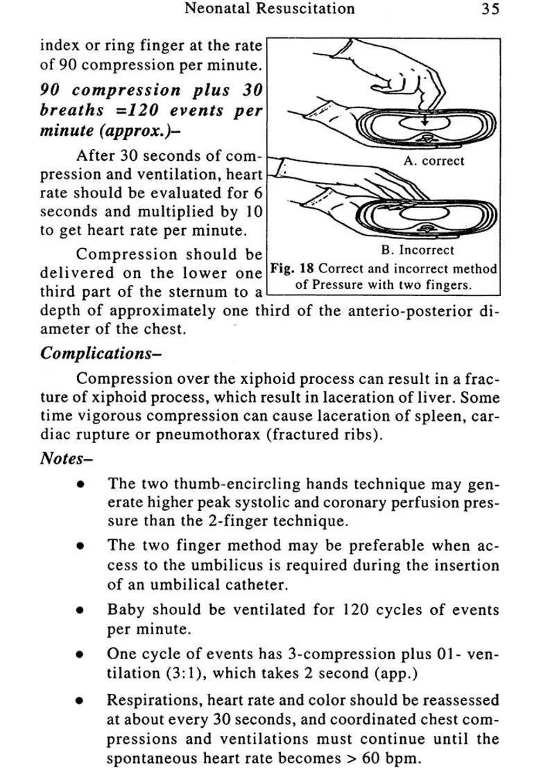 Prana Pratyagamanam (Cardio-Pulmonary Resuscitation) - Indya