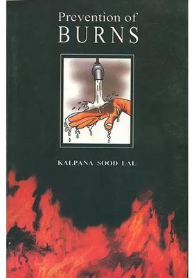 Prevention of Burns (A Handbook on Prevention of Burn Injuries)