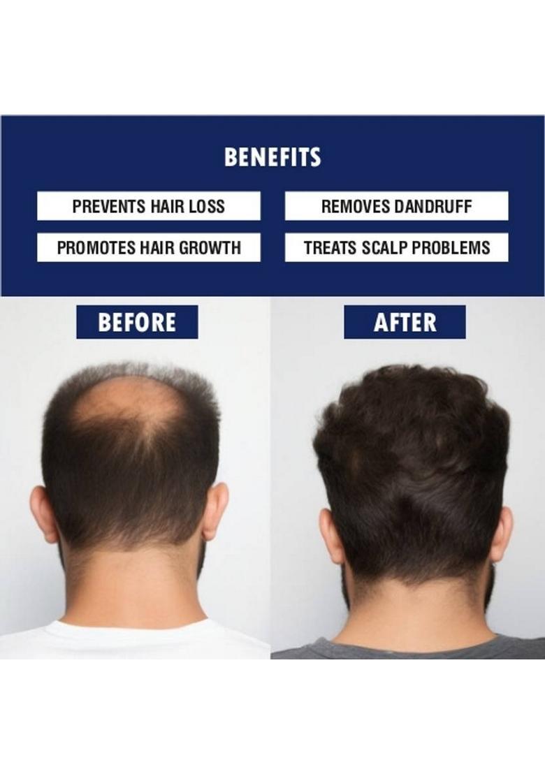 Achyutam Coconut Oil For Hair Growth 100% Pure And Organic 250Ml Plastic Bottle (250 Ml)