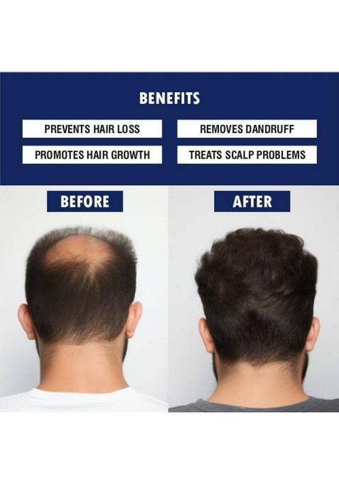 Achyutam Coconut Oil For Hair Growth 100% Pure And Organic 250Ml Plastic Bottle (250 Ml)