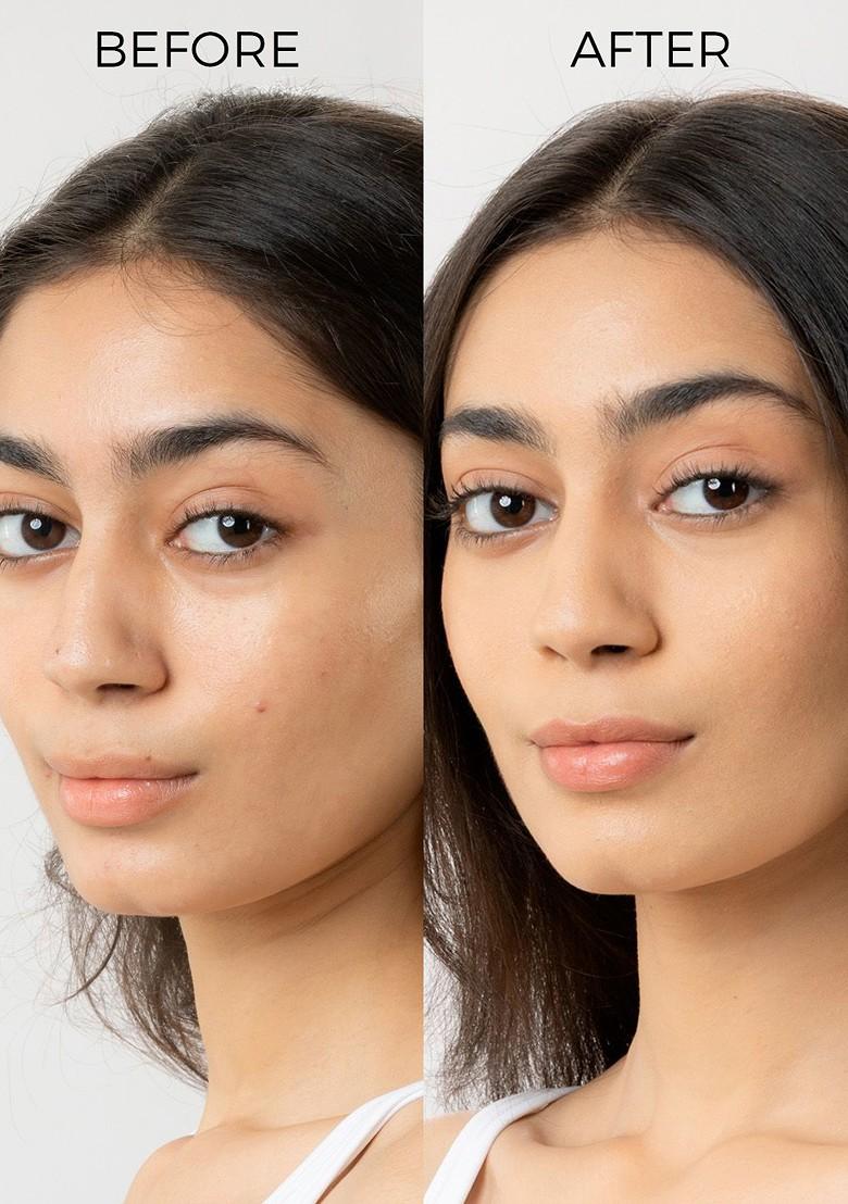 Brillare Salicylic Acid Body Lotion For Clear Skin|Aha Bha Acne Prone Skin