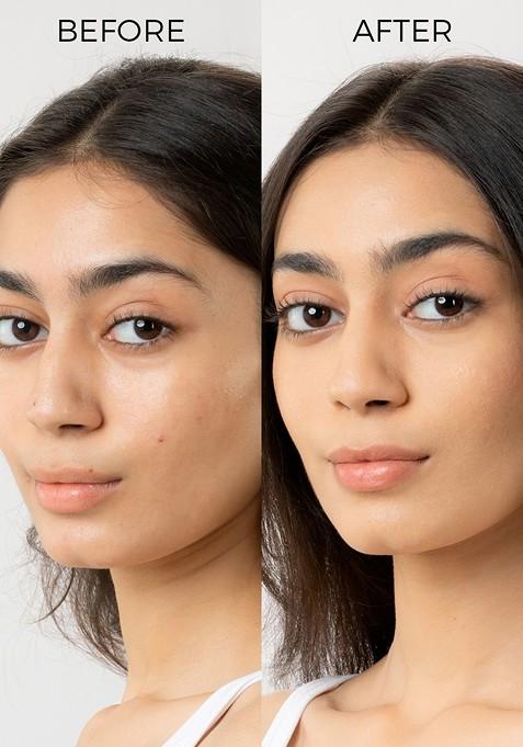 Brillare Salicylic Acid Body Lotion For Clear Skin|Aha Bha Acne Prone Skin