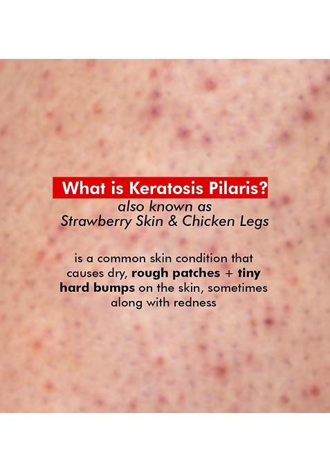 Conscious Chemist Salicylic Acid Body Moisturiser For Pigmentation Bumps Removal 100G