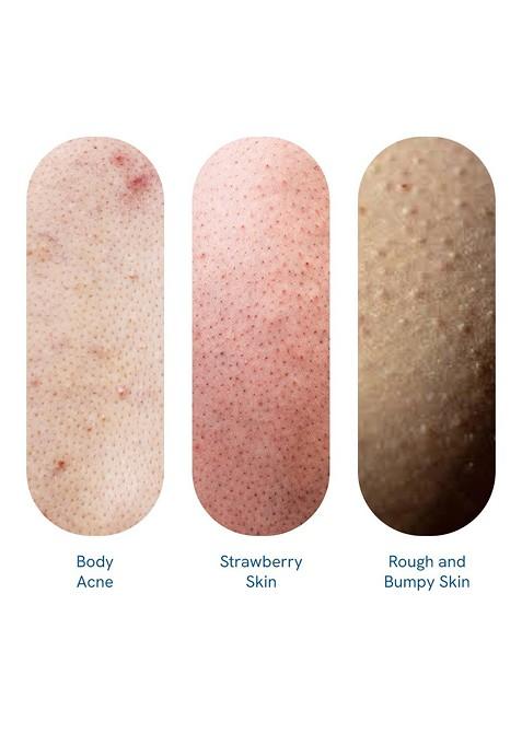 Be Bodywise 1 Salicylic Acid Body Wash Prevents Acne Exfoliate Dead Skin 700Ml