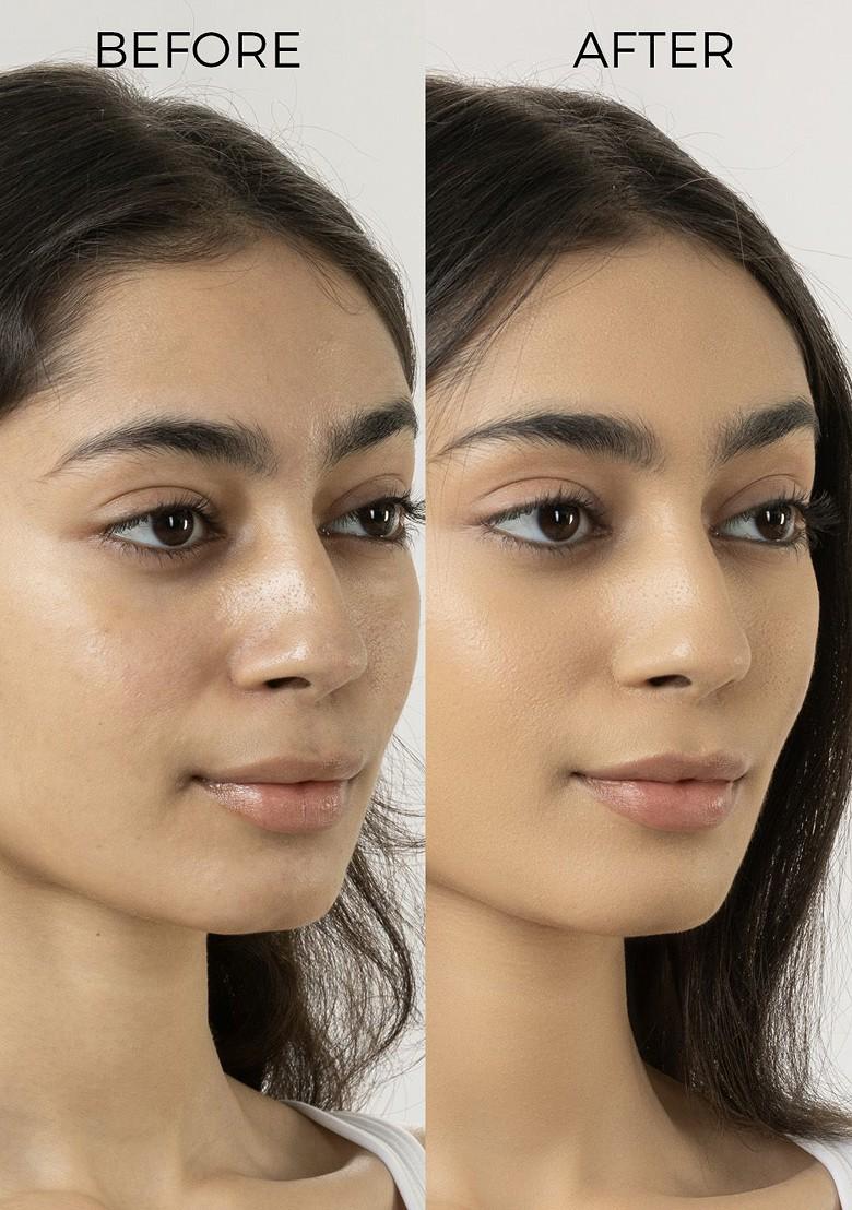 Brillare Salicylic Lactic Acid Body Wash For Clear Purified Acne Prone Skin 200Ml