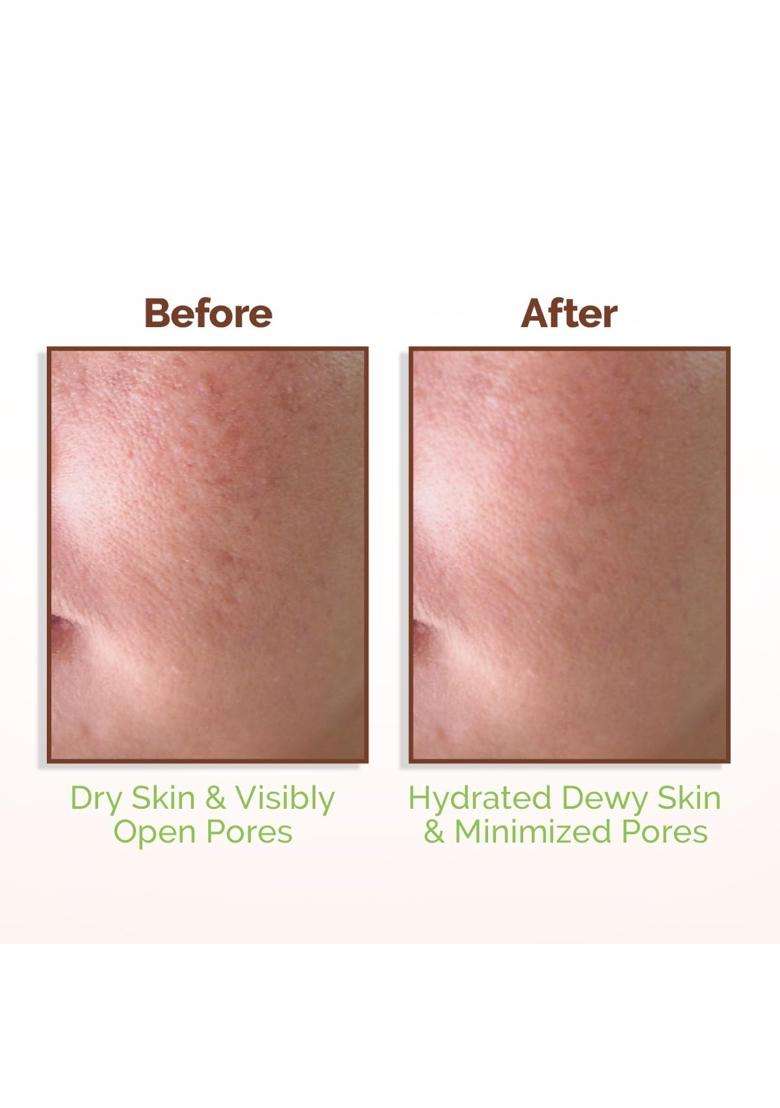 Mamaearth Rice Water Dewy Face Toner with Rice Water & 4% Niacinamide for Glass Skin 150 ml | Intensely Hydrates | Minimizes Pores | Even Skin Tone - Indya