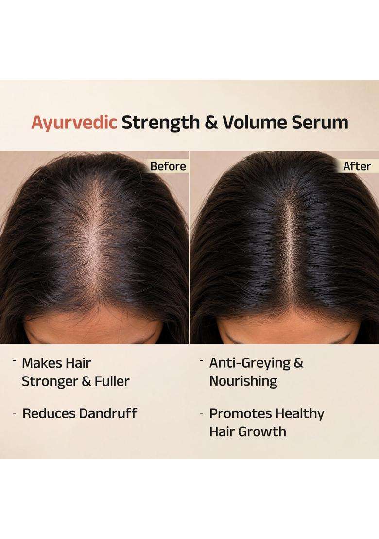 Vedix Vithan Pro Ayurvedic Hair Growth Serum For Men & Women l 40 ml | Authentic Traditional Formula - Indya