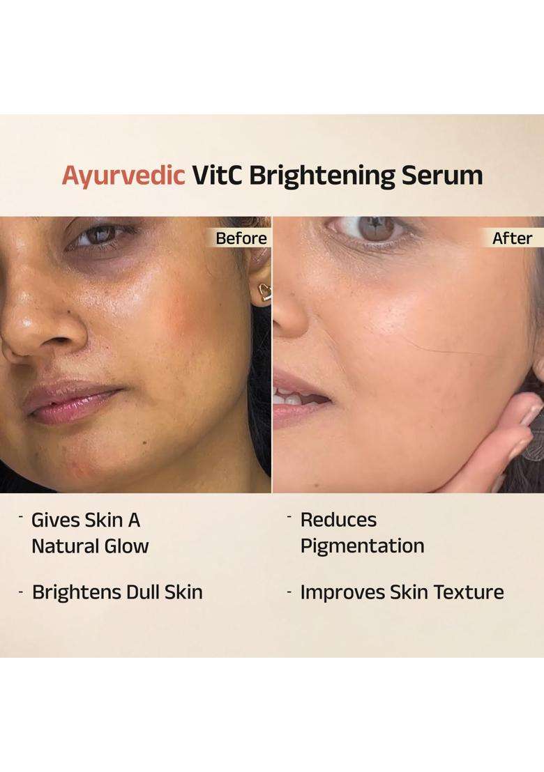 Vedix Aloka Ayurvedic Glow & Brightening Face Serum for Tanned Skin 25 ml | Authentic Traditional Formula - Indya