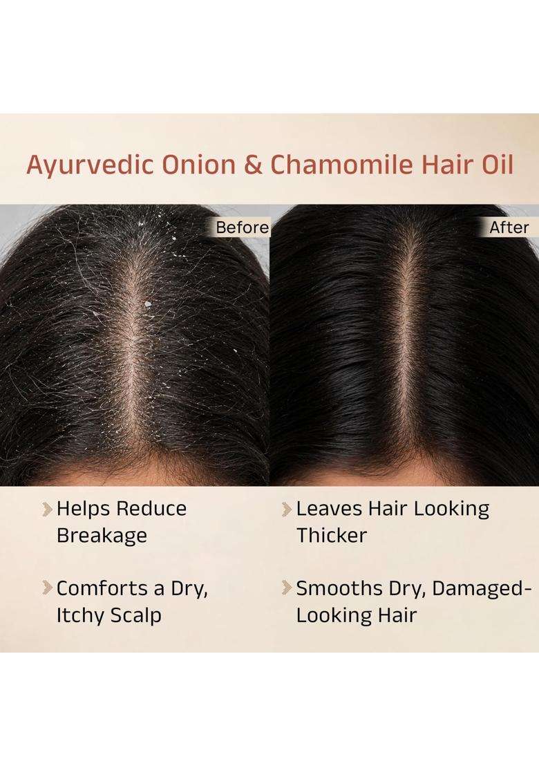 Vedix Praya Ayurvedic Anti-Hairfall Oil 100 ml | Authentic Traditional Formula | Oily Scalp & Wavy Hair l 100 ml - Indya