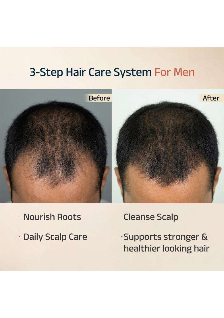 Vedix Ayurvedic Anti-Hairfall Kit for Men 240 ml | Authentic Traditional Formula | Oil, Shampoo & Serum - Indya
