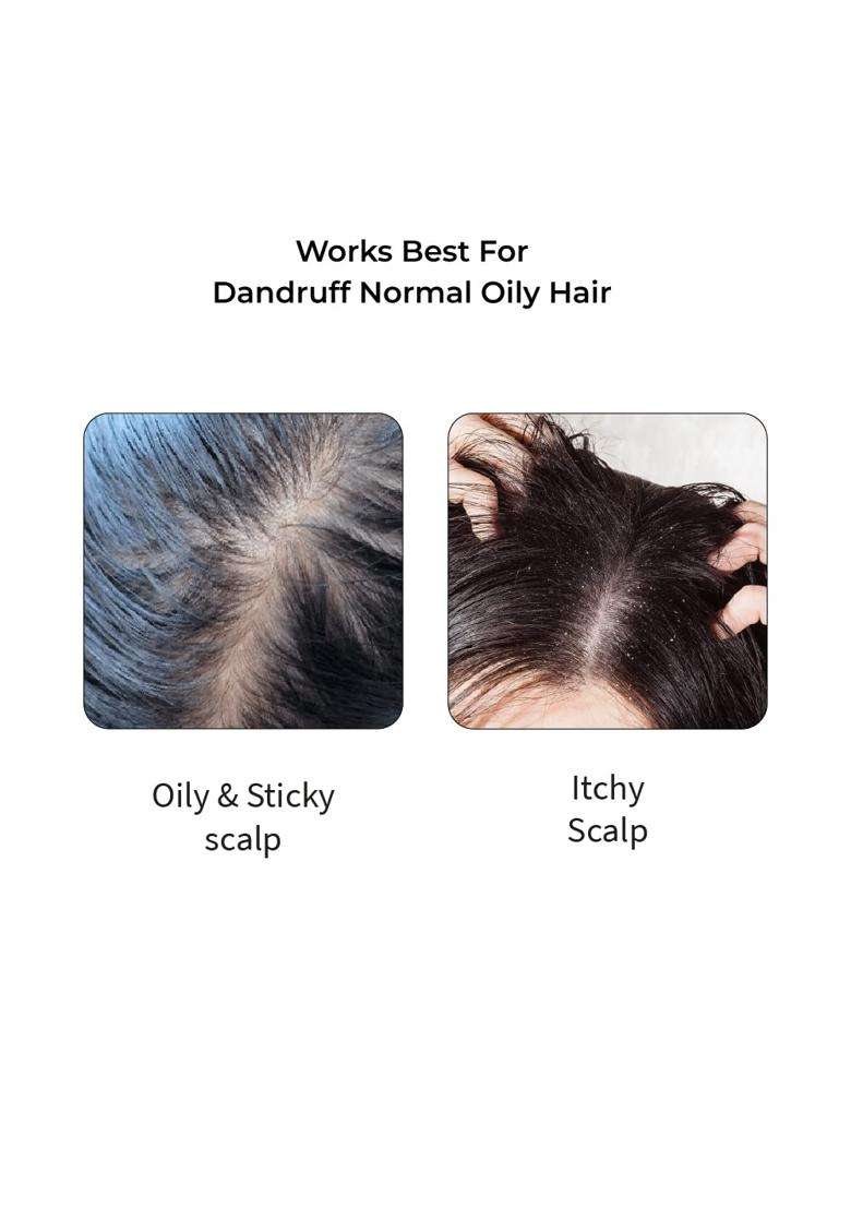 Vedix Ayurvedic Anti-Dandruff Oil & Shampoo Combo 200 ml | Authentic Traditional Formula | Oily Scalp & Wavy Hair - Indya